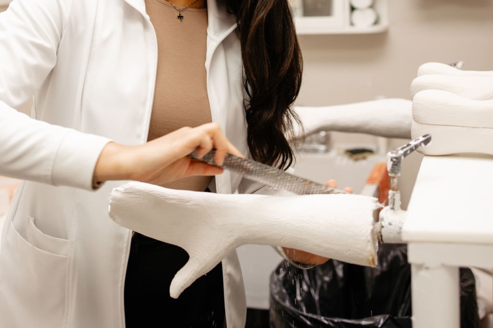 Femme en blouse blanche en train de confectionner un plâtre pour une future prothèse qui traitera le syndrome tunnel carpien